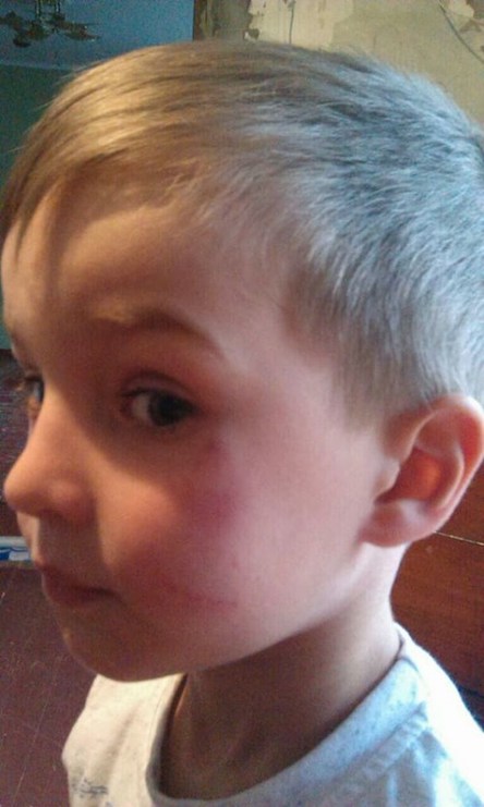 Свежие новости: Скандал на Киевщине: в детсаду заведующая швырнула ребенка лицом о пол