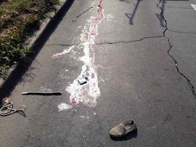 Свежие новости: В Николаеве водители автомобилей не пропустили «скорую»: человека не спасли