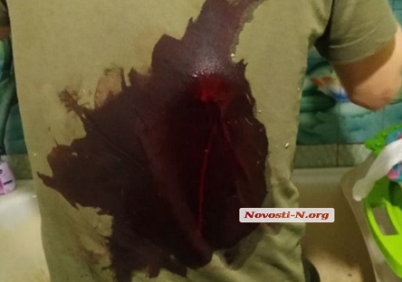 Свежие новости: В Николаеве жена в ходе ссоры всадила в спину мужу кухонный топорик