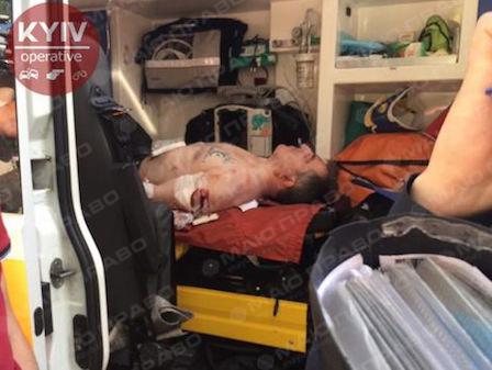 Свежие новости: Нападение на чеченских добровольцев Окуеву и Осмаева: киллер заговорил и дал первые показания