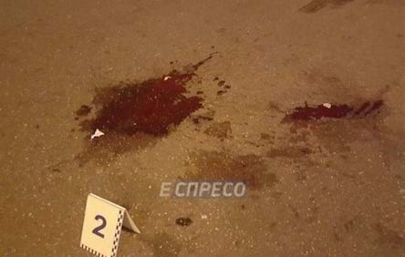 Свежие новости: Резонансное ДТП с сыном Шуфрича: появилось новое видео с пострадавшим