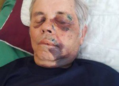 Свежие новости: На Закарпатье жестоко избили 78-летнего настоятеля храма УПЦ