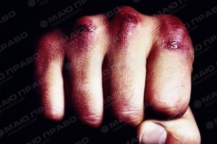 Свежие новости: Никто не помог: в Киеве на улице мужчину забили насмерть