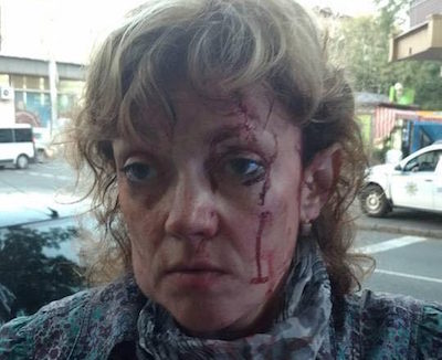 Свежие новости: В центре Одессы напали на активистку, известную своей «антимэрской» позицией