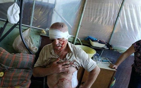 Свежие новости: В Одессе подстрелили вора-домушника