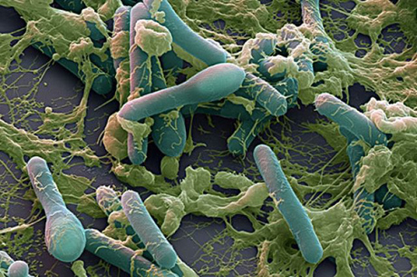 Свежие новости: На Херсонщине мужчина умер от ботулизма