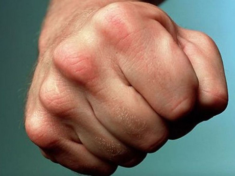 Свежие новости: В Кропивницком мужчину забили до смерти