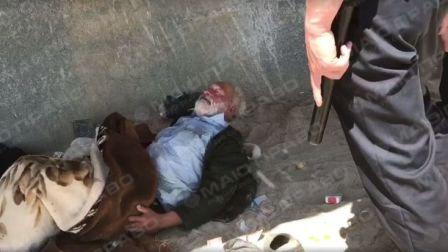 Свежие новости: Одесские патрульные проигнорировали просьбу о медпомощи