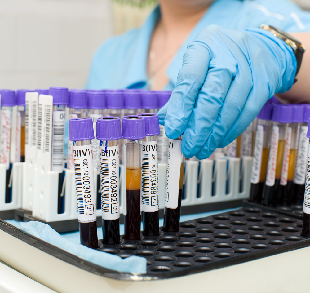 Фото новости: Новый анализ крови  позволит выявить любые заболевания Свежие новости: Новый анализ крови  позволит выявить любые заболевания