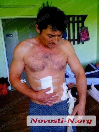 Свежие новости: ВИДЕО: В Николаеве сотрудники частной охранной фирмы покалечили участника АТО