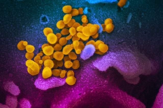 Свежие новости: В Израиле разработали 10-секундный тест на COVID-19, вскоре он может появится в Украине