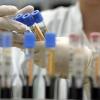 Свіжі новини: В Украине разрабатывают собственные тесты на коронавирус - СМИ