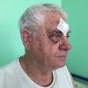 Фото новости: В Харькове участковый во время конфликта в трамвае разбил лицо пенсионеру 18+ Свежие новости: В Харькове участковый во время конфликта в трамвае разбил лицо пенсионеру 18+