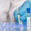 Свіжі новини: В Украине произошла вспышка COVID-19 на птицефабрике