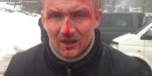 Фото новости: Избиение Левченко: появилось провокационное видео с нардепом Свежие новости: Избиение Левченко: появилось провокационное видео с нардепом