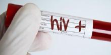 Свежие новости: В Николаеве растет показатель распространенности ВИЧ-инфекции