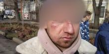 Свежие новости: Полиция вручила подозрение водителю «Mercedes», который сбил насмерть женщину в центре Николаева