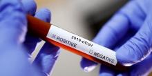 Свежие новости: Разработанные Украиной тесты на коронавирус могут появится в следующий вторник