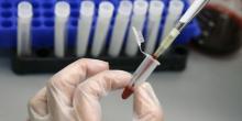 Фото новости: В Миколаєві зареєстровано 60 випадкiв захворювань на вірусний гепатит А Свежие новости: В Миколаєві зареєстровано 60 випадкiв захворювань на вірусний гепатит А