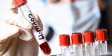 Свежие новости: В Николаевской области показатель заболеваемости COVID-19 превышен почти в два раза