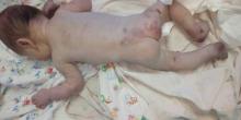 Фото новости: Скончался малыш, подброшенный врачам в коробке на Николаевщине Свежие новости: Скончался малыш, подброшенный врачам в коробке на Николаевщине