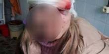 Свежие новости: В Николаевской области мужчина похитил жену, угрожая убить её и себя, совершив ДТП на трассе