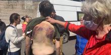 Свежие новости: Нечеловеческая жестокость: в сети показали фото зверски избитых протестующих в Беларуси