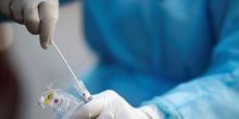 Свежие новости: Всем заболевшим Covid-19 в Коблево оказана медицинская помощь, а контактные лица находятся на самоизоляции