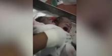 Фото новости: В Черновцах родился ребенок с двумя головами Свежие новости: В Черновцах родился ребенок с двумя головами