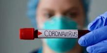 Свежие новости: В Николаевской области за сутки зафиксировали 2 новых случая заболевания COVID-19