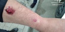 Свежие новости: Во Львове пьяный водитель покусал полицейского