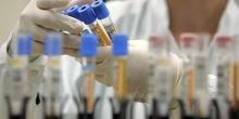 Свежие новости: Каждому третьему европейцу предрекли слабоумие и инсульт