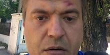 Фото новости: В Херсоне двое неизвестных избили местного журналиста Свежие новости: В Херсоне двое неизвестных избили местного журналиста