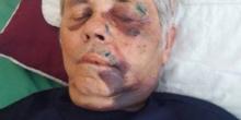 Свежие новости: На Закарпатье жестоко избили 78-летнего настоятеля храма УПЦ