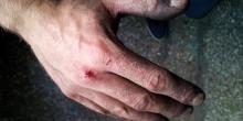 Фото новости: В Николаеве маршрутчик вытянул женщину на остановке и кулаками избивал по лицу, - свидетели происшествия Свежие новости: В Николаеве маршрутчик вытянул женщину на остановке и кулаками избивал по лицу, - свидетели происшествия