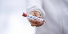Свежие новости: В Вознесенске зарегистрированы 3 случая заражения штаммом «Дельта»