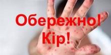 Свежие новости: У закладах освіти посилять заходи імунізації для протидії кору