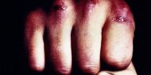 Фото новости: В Баштанке 17-летний парень убил пенсионера Свежие новости: В Баштанке 17-летний парень убил пенсионера