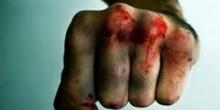 Фото новости: На Николаевщине полицейские задержали мужчину, который до смерти забил знакомого Свежие новости: На Николаевщине полицейские задержали мужчину, который до смерти забил знакомого