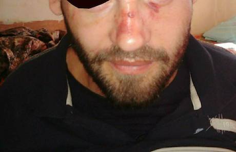 Свежие новости: Заключённый из Одесского СИЗО перерезал себе горло