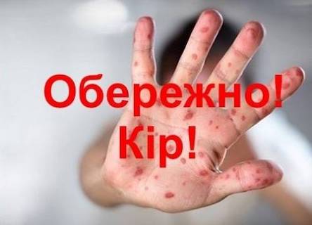 Свежие новости: У закладах освіти посилять заходи імунізації для протидії кору