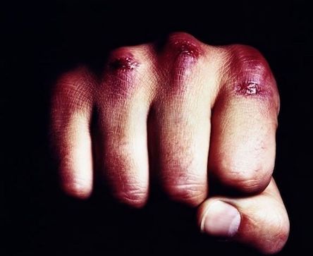Фото новости: В Баштанке 17-летний парень убил пенсионера Свежие новости: В Баштанке 17-летний парень убил пенсионера