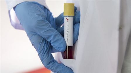 Свежие новости: В Николаевской области зарегистрировано 427 новых случаев COVID-19