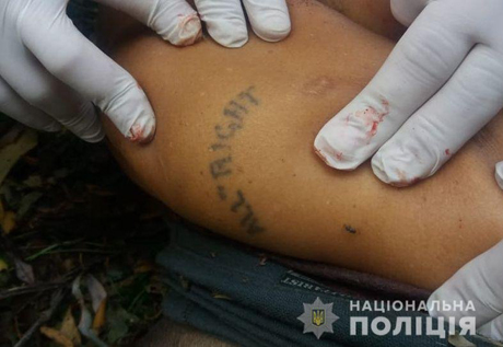 Фото новости: На Николаевщине охотники нашли труп мужчины с огнестрелом Свежие новости: На Николаевщине охотники нашли труп мужчины с огнестрелом