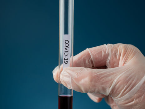 Свежие новости: ВОЗ заявила о новой волне коронавируса: молодые стали заражаться чаще