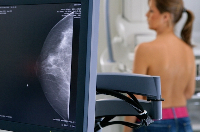 Свежие новости: Ни одного аппарата в городе: горздрав Николаева планирует закупить цифровой маммограф