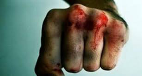 Свежие новости: На Николаевщине полицейские задержали мужчину, который до смерти забил знакомого